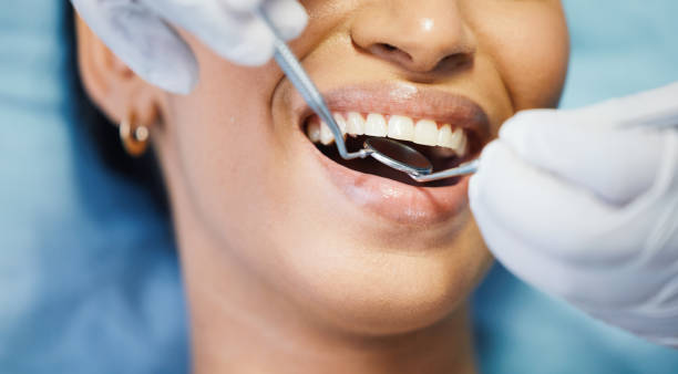 Best Same-Day Emergency Dental Services in Cleveland Heights, OH